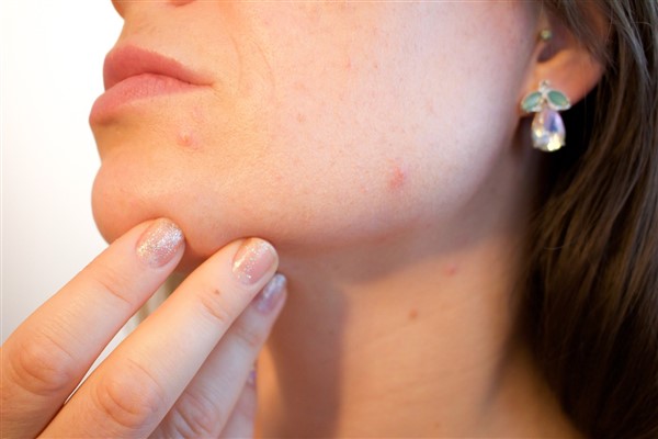 Albanese: “İleri melanom artık tedavi edilebilir bir hastalık”