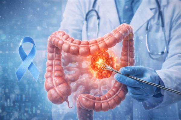 Kolon Kanseri Farkındalık Ayı'nda erken teşhis uyarısı